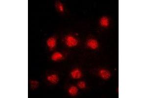 Immunofluorescent analysis of RB1 (pS807) staining in HeLa cells. (Retinoblastoma 1 Antikörper  (C-Term, pSer807))