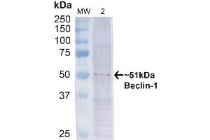 Western blot analysis of Human Cervical cancer cell line (HeLa) lysate showing detection of ~51 kDa Beclin 1 protein using Rabbit Anti-Beclin 1 Polyclonal Antibody (ABIN2868749). (Beclin 1 Antikörper  (APC))