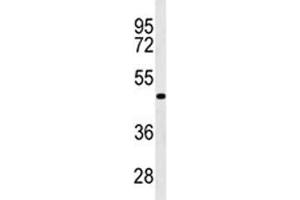 Western blot analysis of GATA6 antibody in WiDr lysate. (GATA6 Antikörper  (AA 254-279))