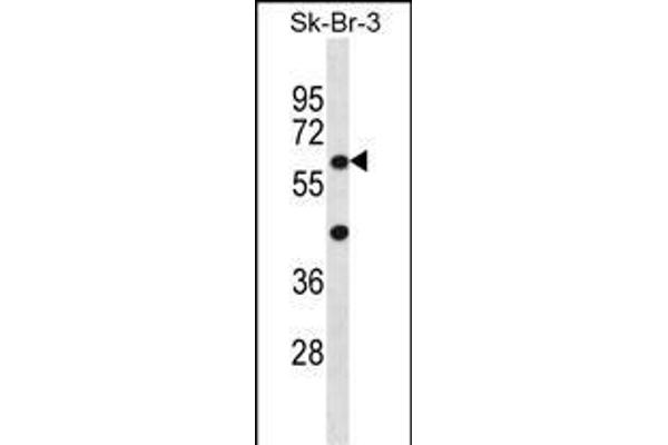 STXBP3 Antikörper  (AA 145-171)
