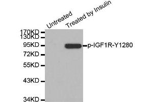 Western blot analysis of extract from 293 cells, using Phospho-IGF1R-Y1280 antibody (ABIN2988067). (IGF1R Antikörper  (pTyr1280))