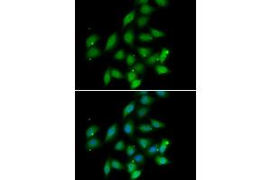 Immunofluorescence analysis of HeLa cells using PPP2CA antibody. (PPP2CA Antikörper)