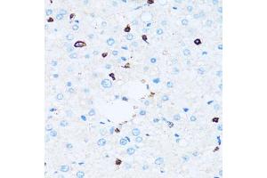 Immunohistochemistry of paraffin-embedded human liver using SPN antibody. (CD43 Antikörper)