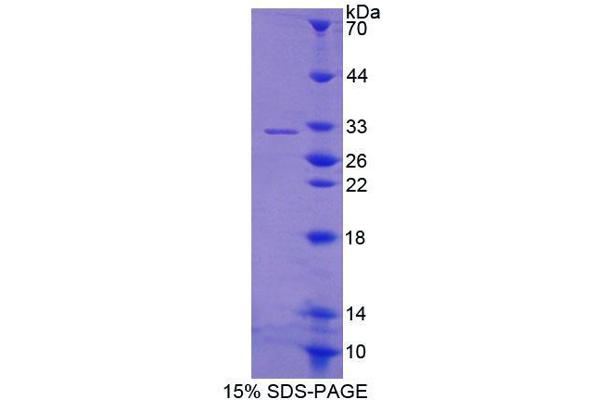 ABCG4 Protein (AA 59-301) (T7 tag,His tag)