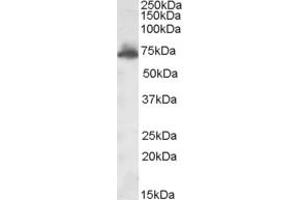 Western Blotting (WB) image for anti-A Kinase (PRKA) Anchor Protein 10 (AKAP10) (AA 28-40) antibody (ABIN290931) (AKAP10 Antikörper  (AA 28-40))