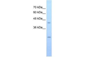 FLJ20489 antibody used at 0. (FLJ20489 (C-Term) Antikörper)