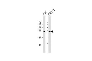 All lanes : Anti-mouse BAD Antibody at 1:1000 dilution Lane 1: A20 whole cell lysate Lane 2: C2C12 whole cell lysate Lysates/proteins at 20 μg per lane. (BAD Antikörper  (AA 90-118))