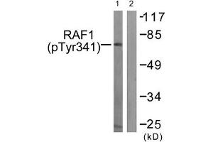 Western blot analysis of extracts from Jurkat cells treated with Paclitaxel using Raf1 (Phospho-Tyr341) Antibody. (RAF1 Antikörper  (pTyr341))
