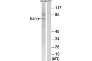 Western Blotting (WB) image for anti-Ezrin (EZR) (AA 446-495) antibody (ABIN2889087) (Ezrin Antikörper  (AA 446-495))