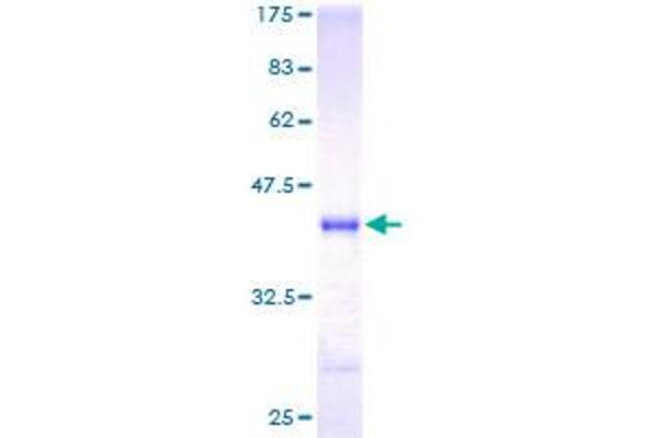 Neurogranin Protein (NRGN) (AA 1-78) (GST tag)