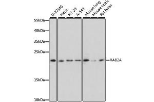 Western blot analysis of extracts of various cell lines, using RAB2A antibody. (RAB2A Antikörper)