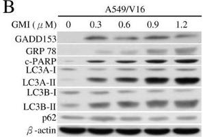 Western Blotting (WB) image for anti-Sequestosome 1 (SQSTM1) antibody (ABIN2854836)