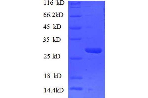 NUP153 Protein (AA 657-880) (His tag)