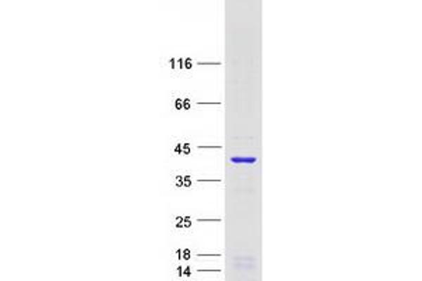 GEM Protein (Transcript Variant 1) (Myc-DYKDDDDK Tag)