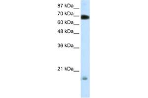 Western Blotting (WB) image for anti-Tripartite Motif Containing 32 (TRIM32) antibody (ABIN2460275) (TRIM32 Antikörper)