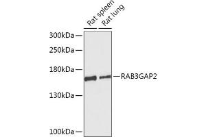 Western blot analysis of extracts of various cell lines, using RG antibody (ABIN7269806) at 1:1000 dilution. (RAB3GAP2 Antikörper  (AA 1-200))