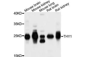 Western blot analysis of extracts of exosome from various cells, using THY1 antibody. (CD90 Antikörper)