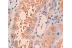 Used in DAB staining on fromalin fixed paraffin- embedded Kidney tissue (HRAS Antikörper  (AA 82-176))