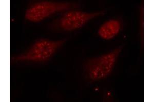 Immunofluorescence staining of methanol-fixed Hela cells, using Phospho-TP53-S315 antibody. (p53 Antikörper  (pSer315))