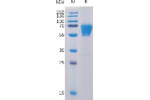 Human CD27 Protein, mFc-His Tag on SDS-PAGE under reducing condition. (CD27 Protein (AA 20-191) (mFc-His Tag))