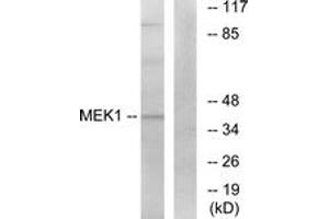Western blot analysis of extracts from K562 cells, treated with, using MEK1 (Ab-291) Antibody. (MEK1 Antikörper  (AA 261-310))
