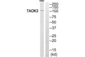 Western blot analysis of extracts from K562 cells, using TAOK3 antibody. (TAO Kinase 3 Antikörper  (Internal Region))