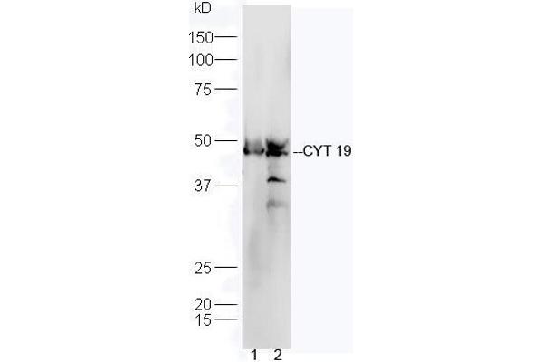 AS3MT Antikörper  (AA 21-120)