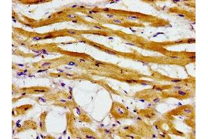 Immunohistochemistry of paraffin-embedded human heart tissue using ABIN7143334 at dilution of 1:100 (ADCY6 Antikörper  (AA 9-118))