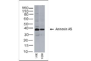 Rabbit anti Annexin A5 on human tonsil lysate (Annexin V Antikörper)