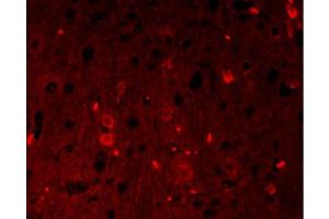 Immunofluorescence (Paraffin-embedded Sections) (IF (p)) image for anti-Catenin, beta (CATNB) (AA 661-781) antibody (ABIN738621)