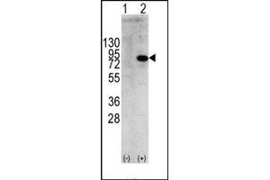 Image no. 1 for anti-Phosphoinositide 3 Kinase, p85 alpha (PI3K p85a) (Tyr580) antibody (ABIN360457) (PIK3R1 Antikörper  (Tyr580))