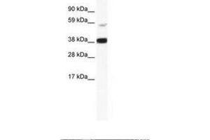 Image no. 1 for anti-V-Rel Reticuloendotheliosis Viral Oncogene Homolog B (RELB) (AA 358-407) antibody (ABIN202760) (RELB Antikörper  (AA 358-407))