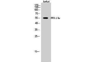 Western Blotting (WB) image for anti-PFK-2 LIV (C-Term) antibody (ABIN3180808) (PFK-2 LIV (C-Term) Antikörper)