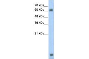 Western Blotting (WB) image for anti-Methyl-CpG Binding Domain Protein 1 (MBD1) antibody (ABIN2460355) (MBD1 Antikörper)