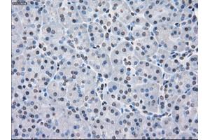 Immunohistochemical staining of paraffin-embedded Adenocarcinoma of colon tissue using anti-PPP5Cmouse monoclonal antibody. (PP5 Antikörper)