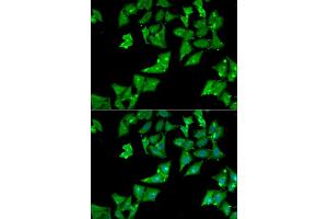 Immunofluorescence analysis of HeLa cells using AGA antibody (ABIN5973763). (AGA Antikörper)