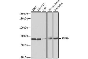 Western blot analysis of extracts of various cell lines, using PTPRN antibody. (PTPRN Antikörper)
