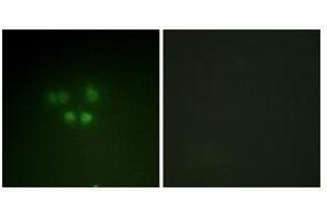 Immunofluorescence analysis of A549 cells using Nibrin antibody . (Nibrin Antikörper)