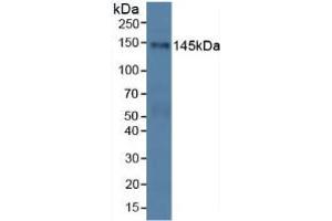 Western blot analysis of Human HeLa cells. (PALLD Antikörper  (AA 1137-1383))