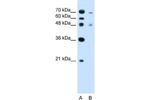 WB Suggested Anti-ZFYVE27 Antibody Titration:  2. (ZFYVE27 Antikörper  (C-Term))