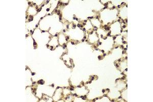Immunohistochemistry (IHC) image for anti-DNA Repair Protein Complementing XP-B Cells (ERCC3) (AA 513-782) antibody (ABIN6218812) (ERCC3 Antikörper  (AA 513-782))