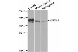 Western blot analysis of extracts of various cell lines, using NFKBIA antibody (ABIN5970533) at 1/1000 dilution. (NFKBIA Antikörper)