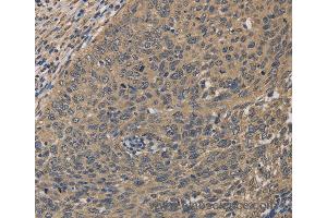 Immunohistochemistry of Human tonsil using HSF1 Polyclonal Antibody at dilution of 1:60 (HSF1 Antikörper)