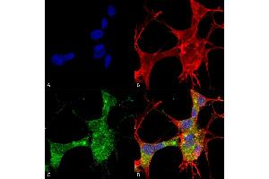 Immunocytochemistry/Immunofluorescence analysis using Mouse Anti-GFAP Monoclonal Antibody, Clone S206A-8 (ABIN1740949). (GFAP Antikörper  (AA 411-422) (Atto 594))