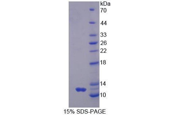 GNG2 Protein