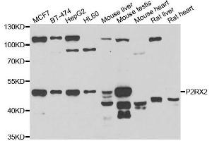 Western blot analysis of extracts of various cell lines, using P2RX2 antibody. (P2RX2 Antikörper)