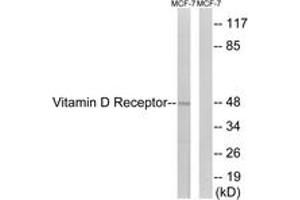 Western blot analysis of extracts from MCF-7 cells, using Vitamin D Receptor (Ab-208) Antibody. (Vitamin D Receptor Antikörper  (AA 181-230))