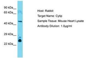 Image no. 1 for anti-Cytohesin 1 Interacting Protein (CYTIP) (C-Term) antibody (ABIN6749905) (CYTIP Antikörper  (C-Term))