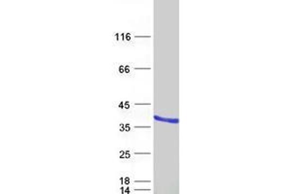 UNC119 Protein (Transcript Variant 1) (Myc-DYKDDDDK Tag)