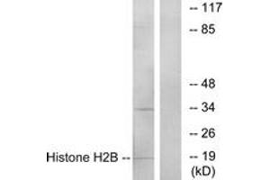 Western blot analysis of extracts from A549 cells, using Histone H2B Antibody. (Histone H2B Antikörper  (AA 1-50))